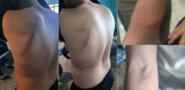 Deportados dos EUA: Brasil remove algemas e defende direitos
